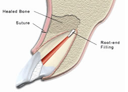 Tooth Anatomy